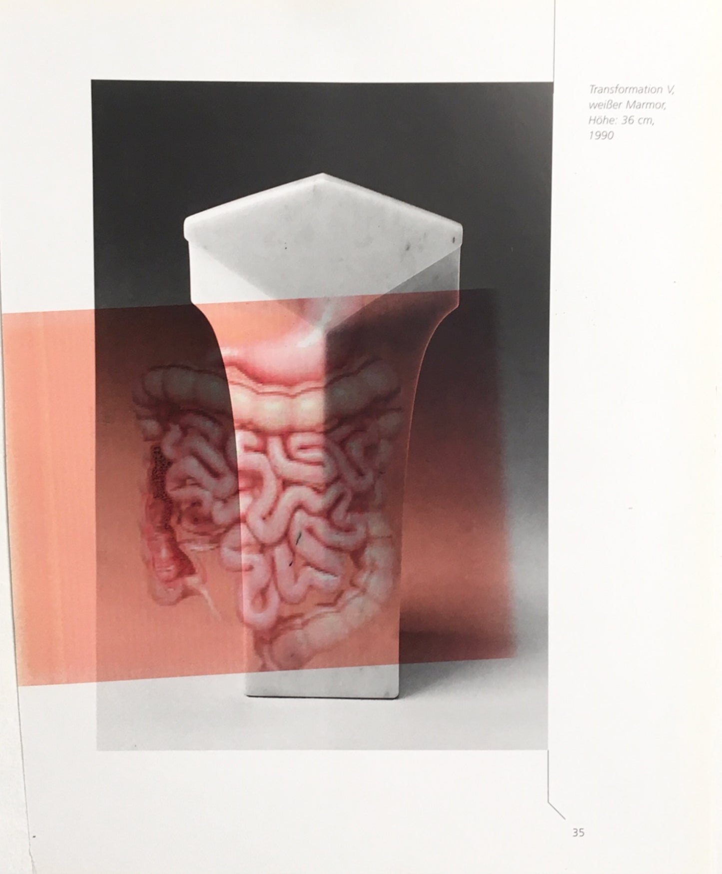 Peter Lamb Brain