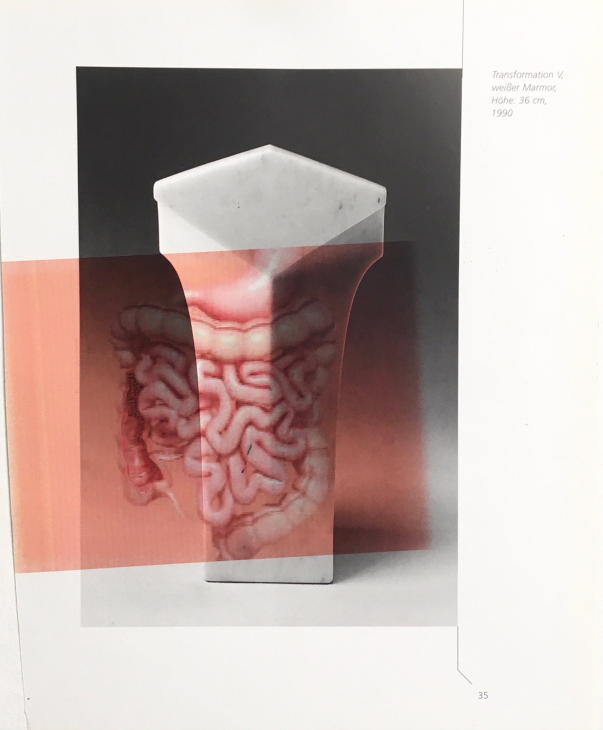 Peter Lamb Brain