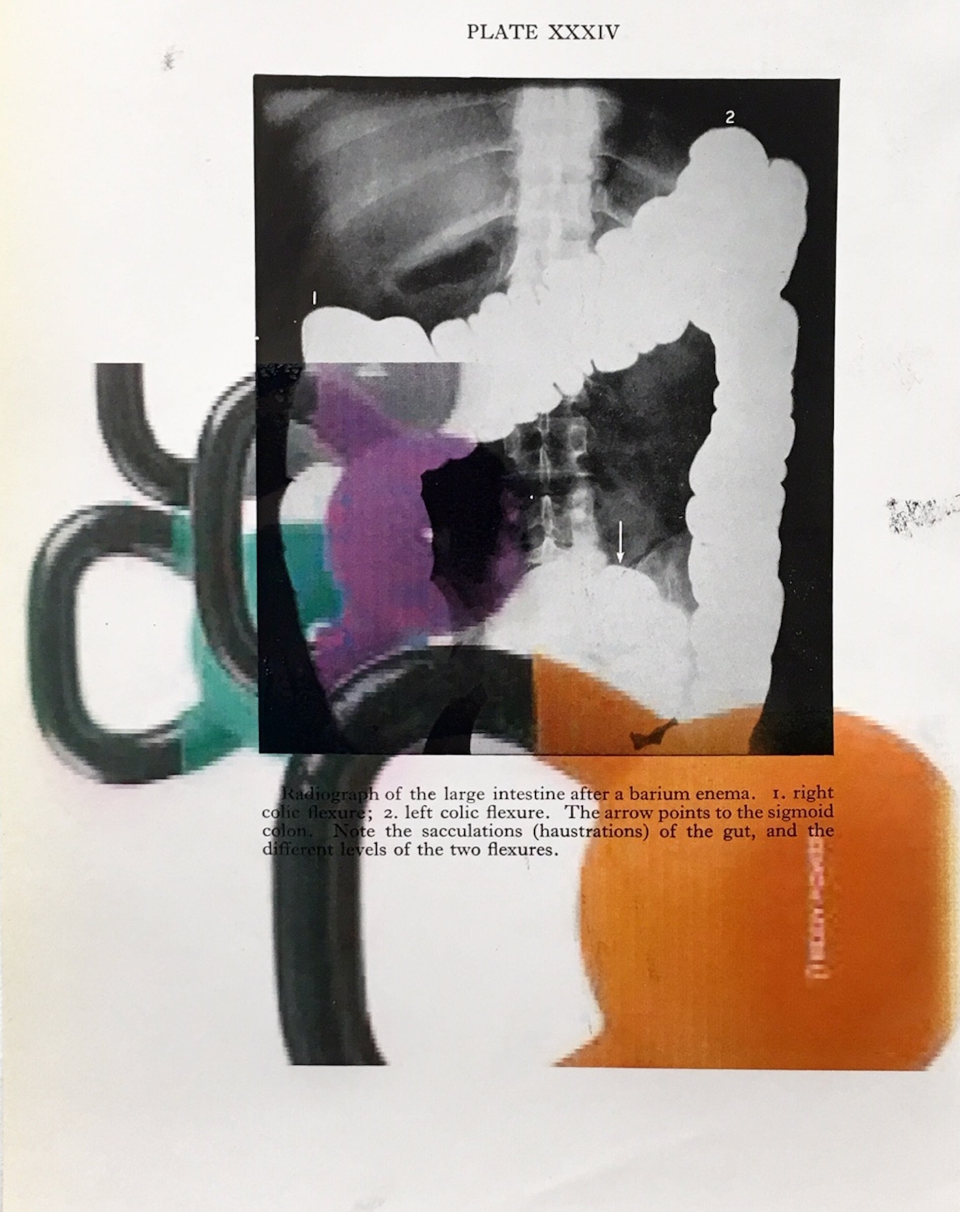 Peter Lamb X Ray
